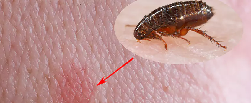 Flea Control for Humans Pflugerville, TX